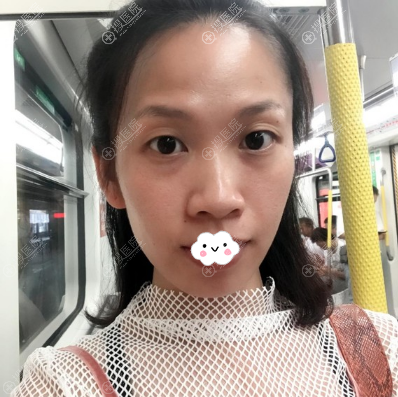 ���ڻ��������˫��Ƥ�Ͷ�����������ۺ��������ұ��9����Ů