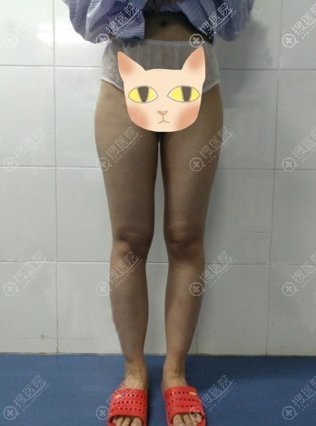 ���˽������֬�������ݵ����ǿ��������������Ļָ�����
