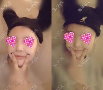 ����¡�Ǻ͵��°�����ָ�һ����