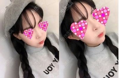 ����will����ҽԺκ����¡�ǵ��°ͻָ���Ч��