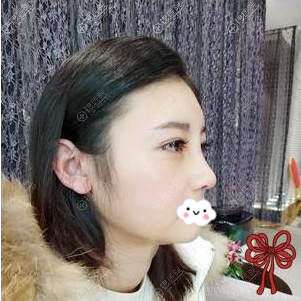 整形医师杨季涛隆鼻好吗 整形医师杨季涛隆鼻好吗