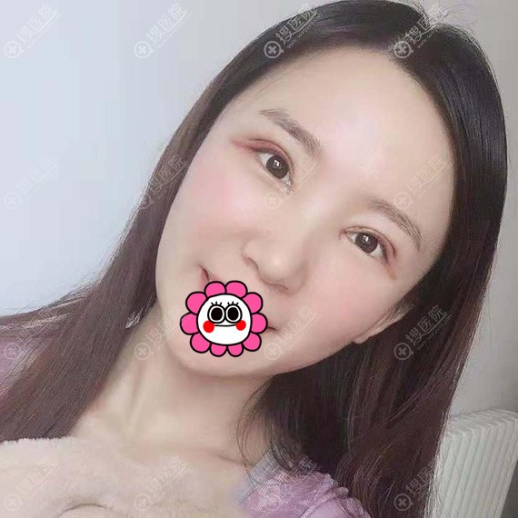 ˫��Ƥ����ָ�����