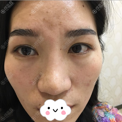 ����������(ԭ��Ψ)��Ȩ������֬�����̫��Ѩ��Խ��Խ������