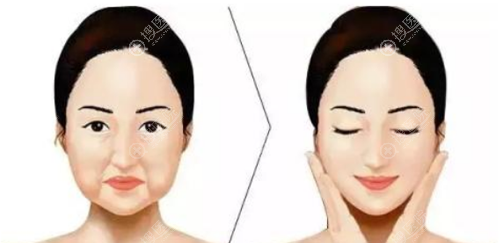 ����֬������沿���´���ô��?����ͨ���´�ԭ����������޸�