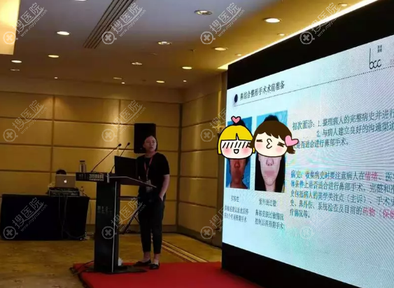 党宁院长讲《鼻整形术中应该注意的细节》 党宁院长讲《鼻整形术中应该注意的细节》