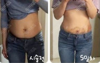 �����������Һ�����֬��ҽԺ������ǰʮ�ĺ���365mc��֬ҽԺ