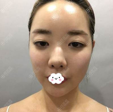 ���ں��������������ӷ������沿����ʧ���޸������ľ������ĵ�