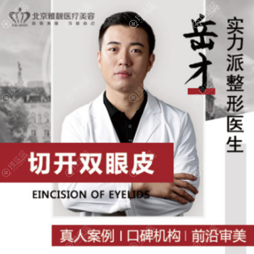 北京雅靓双眼皮医生岳才 北京雅靓双眼皮医生岳才
