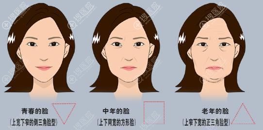 30 40 50岁各阶段出现面部皮肤松弛下垂后适合的手术方法及价格