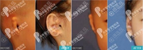 ����profile��С��֢���������˹������ֺü����������ζ���Ǯ