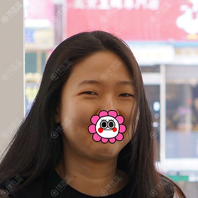 到韩国艾恩做人气三件套前 到韩国艾恩做人气三件套前