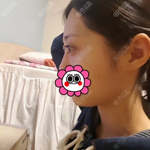 ����ԭ�������Ϊ����������˫��Ƥ�ָ�1���º�о���ͦ�����