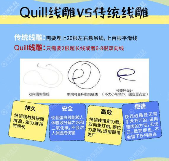 美国快翎线和普通线的区别 美国快翎线和普通线的区别