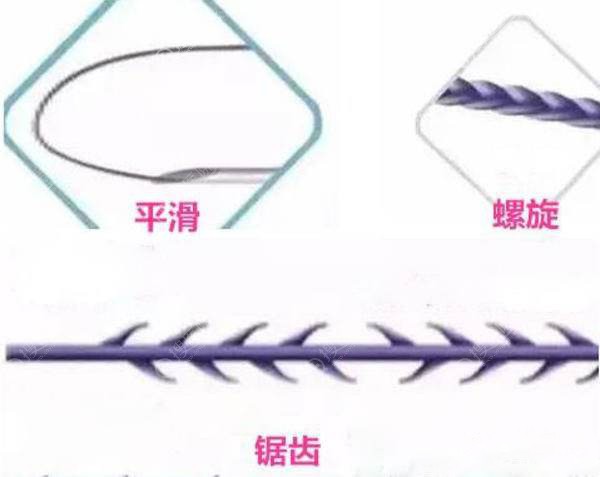 面部埋线提升不同类型的线材 面部埋线提升不同类型的线材