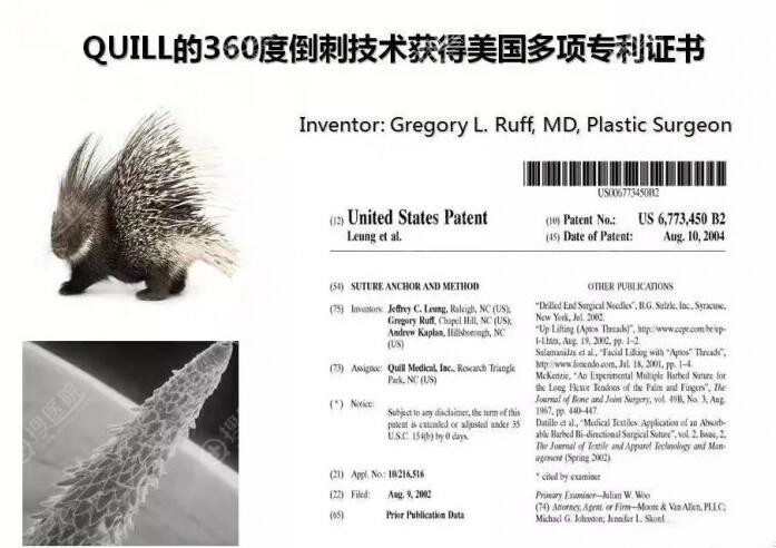 美国快翎线获得多项认证 美国快翎线获得多项认证