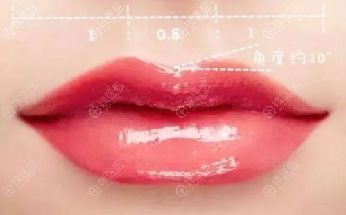 微笑唇给人一种迷人亲切的笑容,用整形达到这种效果3000元够吗?