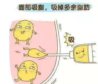 面部吸脂导致皮肤松弛下垂的原因 面部吸脂导致皮肤松弛下垂的原因
