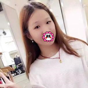 ����Ƥ��˫��Ƥ����վһ�������� ����˫��Ƥ�������ı�һ��