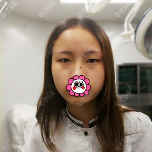 ��˫��Ƥǰ��Ƭ