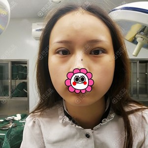 ˫��Ƥ���󼴿�