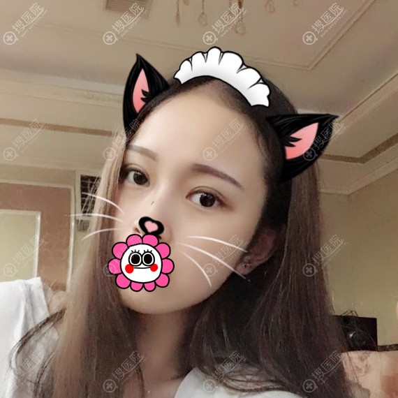 ������˫��Ƥ�ָ�һ����Ч��
