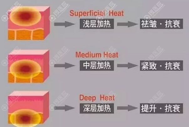深入层次不同作用不同 深入层次不同作用不同