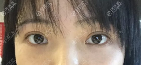 �ָ�24���˫��ƤЧ��