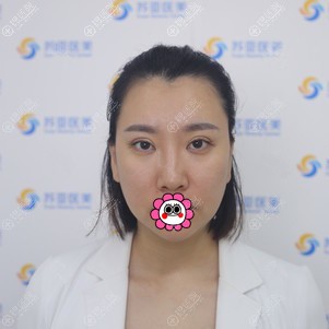 用埋线提升来延缓衰老我找的是唐山美联臣李春雷