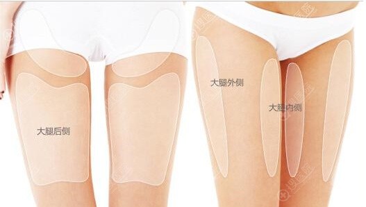 大腿脂肪分布示意图 大腿脂肪分布示意图