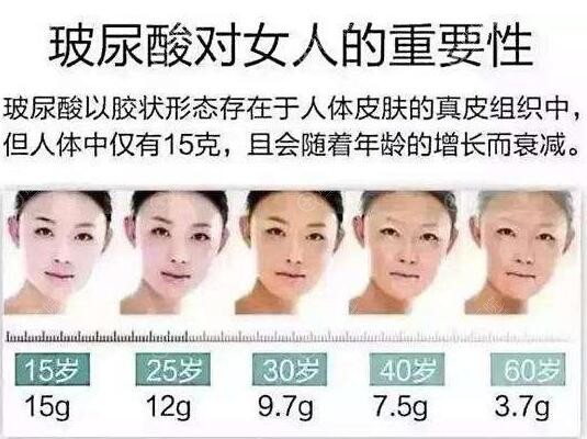 玻尿酸对女人的重要性 玻尿酸对女人的重要性