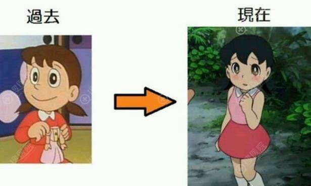 整容就必须变成网红脸吗?不,它只是一个时期的审美标准