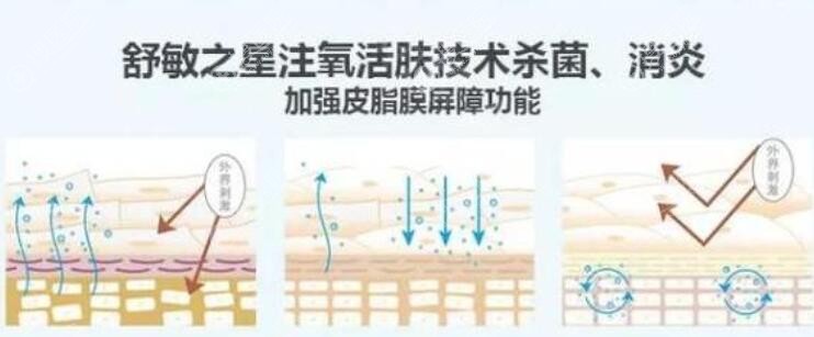 舒敏之星有杀菌消炎的功能 舒敏之星有杀菌消炎的功能
