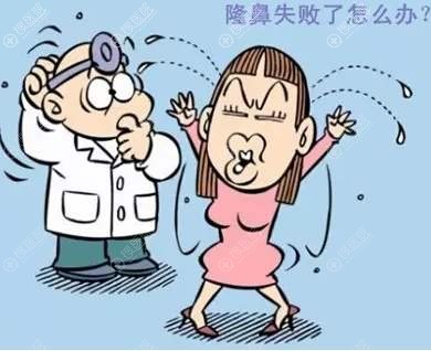隆鼻失败后取出假体鼻子会变形吗 隆鼻失败后取出假体鼻子会变形吗