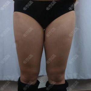 �˶�����ûЧ����ʧȥ��������������������������֬���߽ݾ���