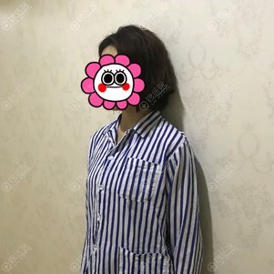 有人说自体脂肪隆胸坑人可我在泉州脂管加做的二次填充效果不错