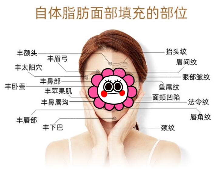 面部需要填充部位示意图 面部需要填充部位示意图