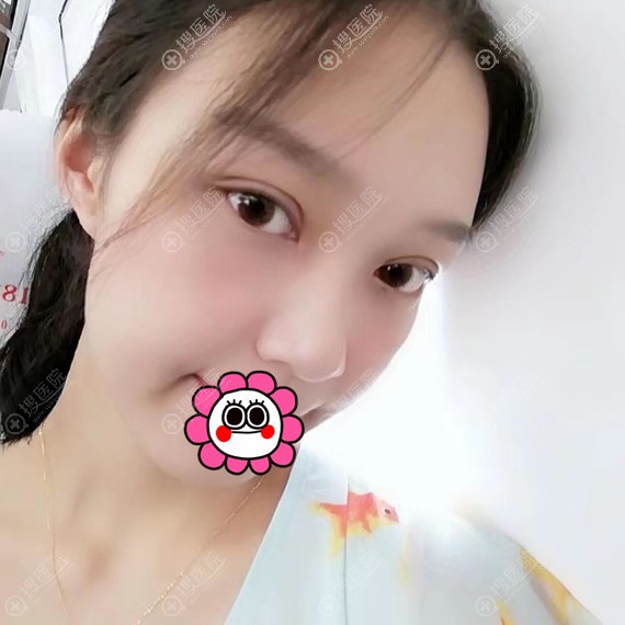 ˫��Ƥ�޸��ָ�9��