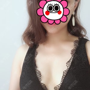 西安画美维密深V动感丰胸吸引了我,找余克锋做了曼托假体隆胸