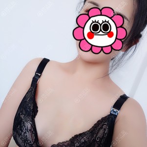 我找北京隆胸好的医生韦元强做自体浓缩脂肪丰胸效果好吗