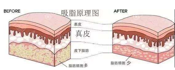 ��֬ԭ��ͼ