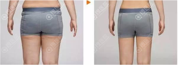 ������֬����Ч��