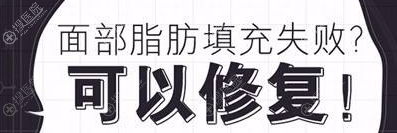 面部脂肪填充失败如何修复 面部脂肪填充失败如何修复