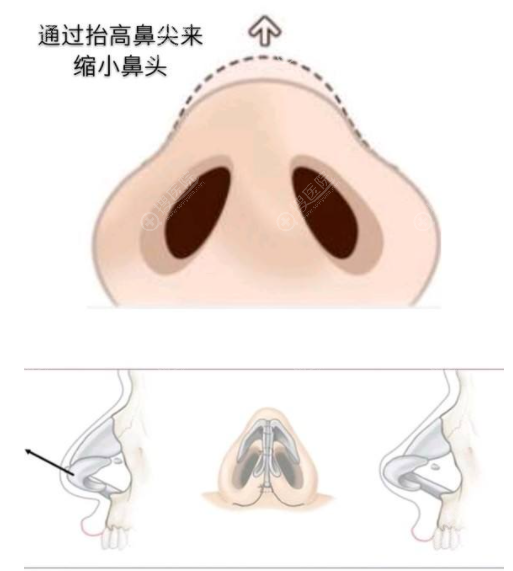 ���Ǽв�����С����������ͷ��С������ȫ��