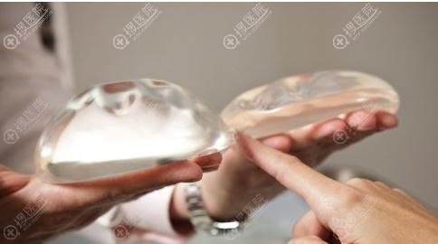 假体隆胸取出多少钱?取出后可以马上放新的假体吗?
