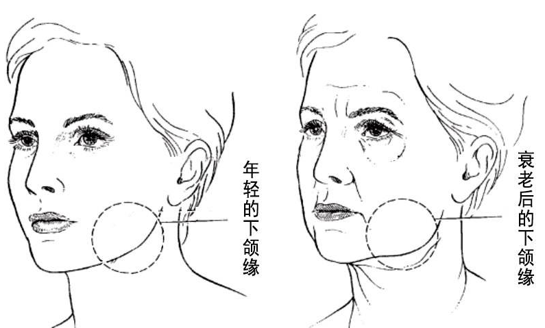 你对小切口面部提升手术真的了解吗?那么SMAS和MACS有什么区别