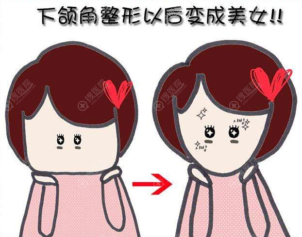 脸太宽了只能磨骨吗?那是因为做下颌角磨骨改脸型瘦脸效果明显