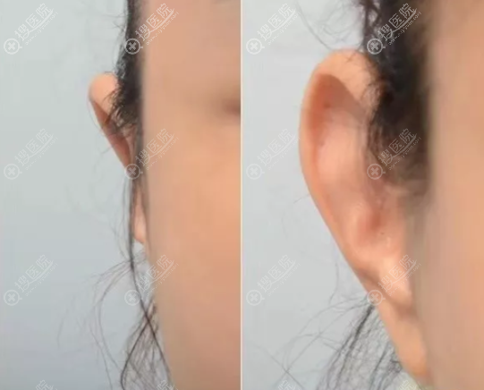 ����������������Ŷ���Ǯ��˳���˽��¶����������Ľ�������