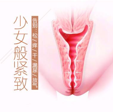 体验3D生物束带紧缩术缩阴效果挺好的,价格也就一万多