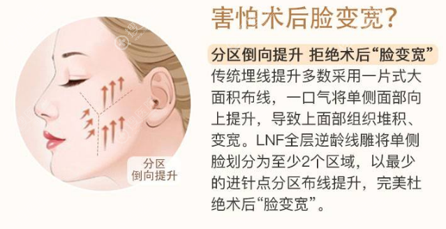埋线提升做完脸又宽又不对称怎么办?我来告诉你不满意怎么调整