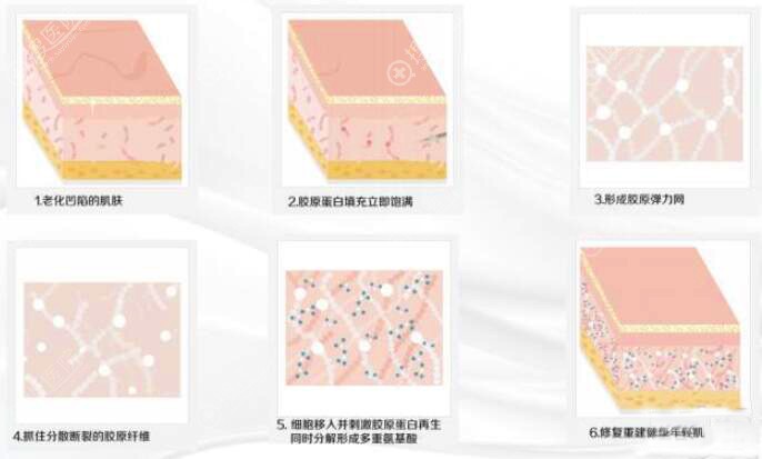 双美胶原蛋白作用 双美胶原蛋白作用